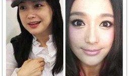 爆料女星削骨视频大全集,女星削骨手术全记录